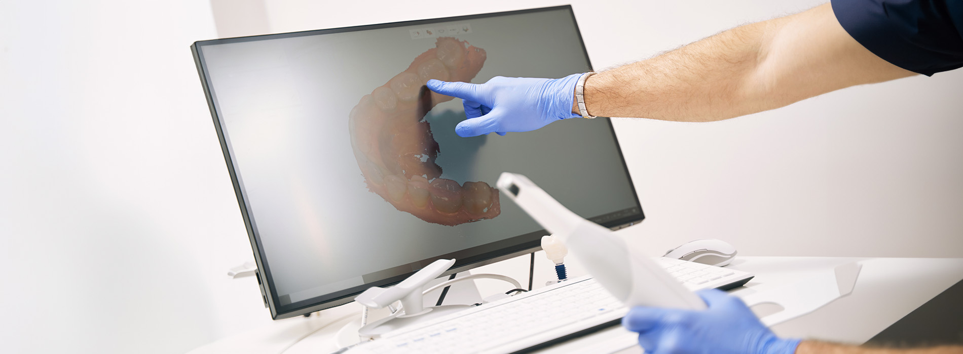 A person in a blue shirt is using a laptop with their left hand, wearing protective gloves.