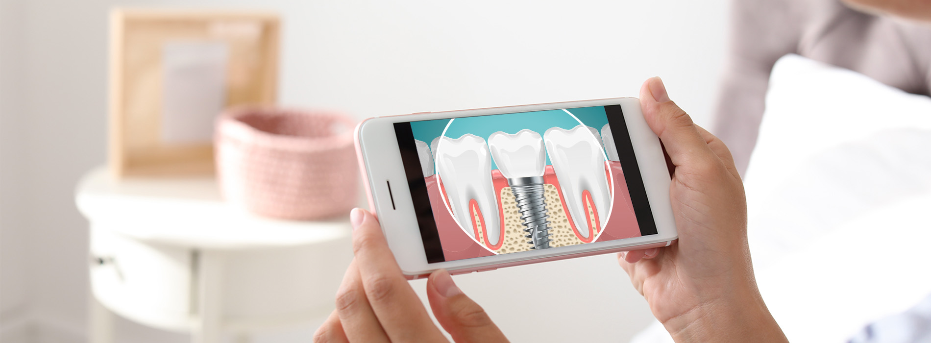 Person holding smartphone displaying dental implant simulation.